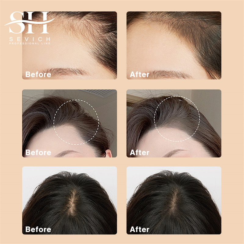 SEVICH 12g Hairline Powder Wit - Rooting Hormone Powder incelemesi ve fiyatı